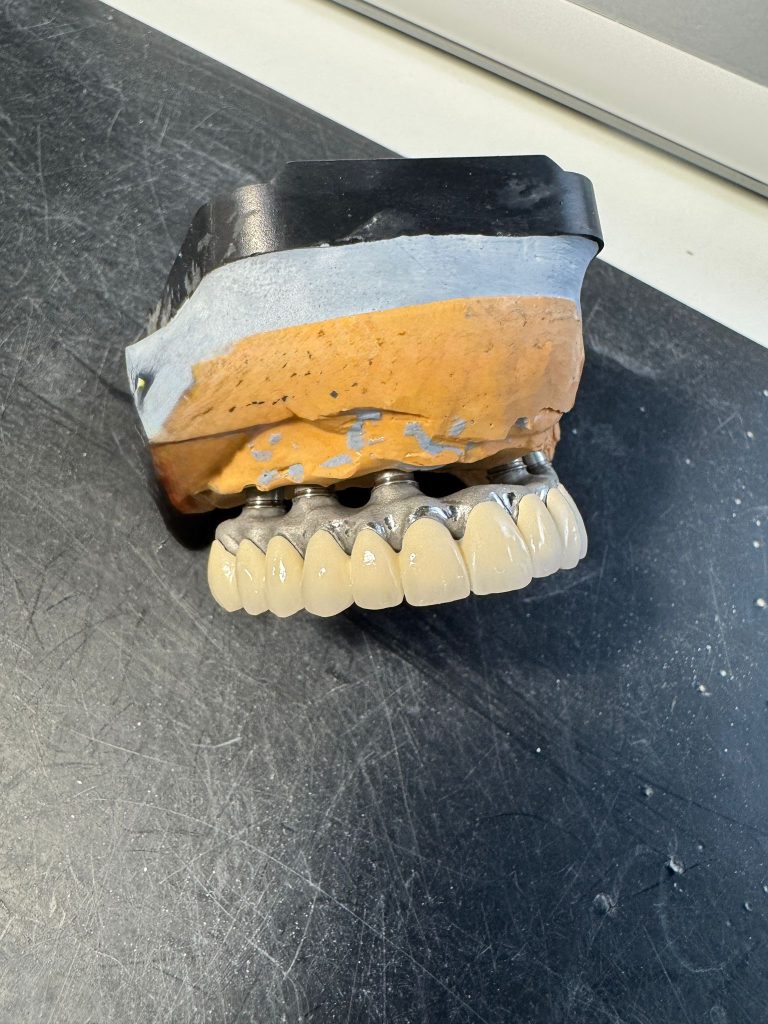 IMPLANT
