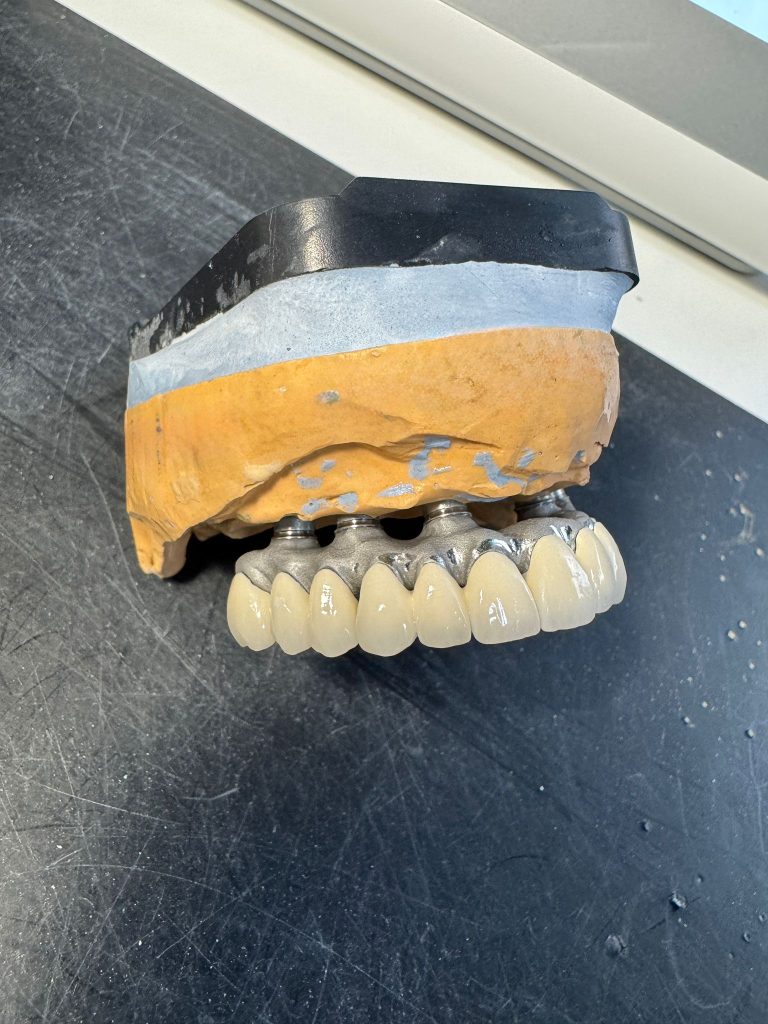IMPLANT2