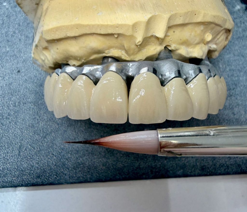 implant3