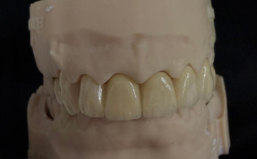 Lucrări Ceramice