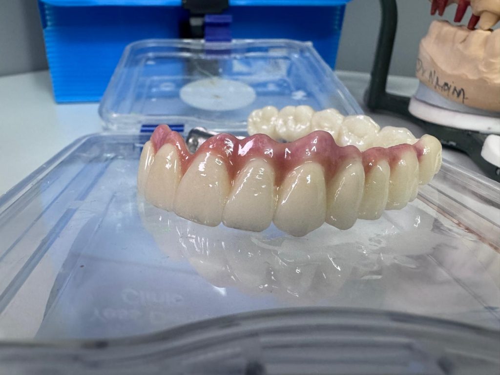 Lucrări Ceramice445