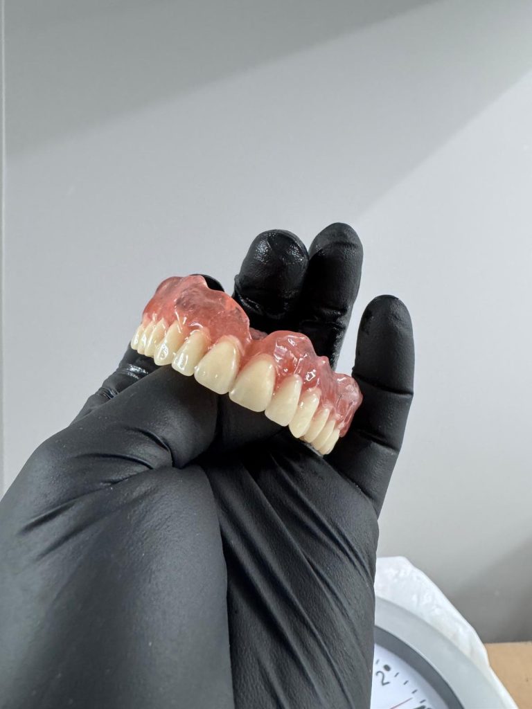 LUCRARI Proteze 4